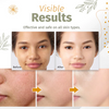SpotFree® | Skin Spot Solution Serum