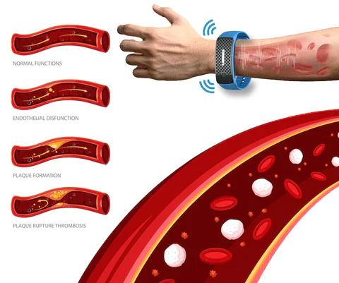 UltrasonicBracelet® | Ultraschall Armband zur Geweichtsreduzierung